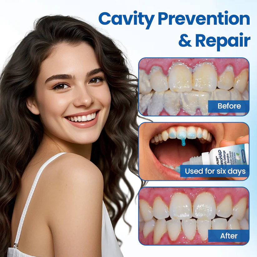 Lyyeto®  NanoHAP Tooth Defense Serum