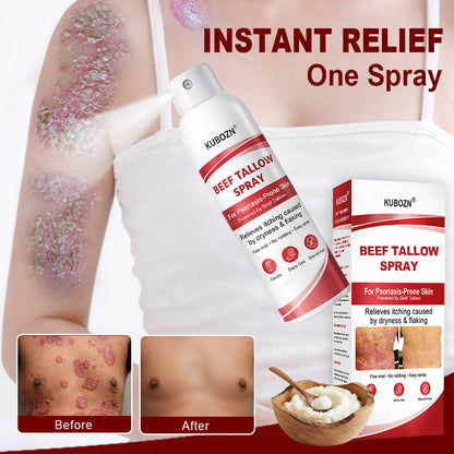 Lyyeto®  Beef Tallow Spray for Itchy. Flaky Psoriasis Skin 1