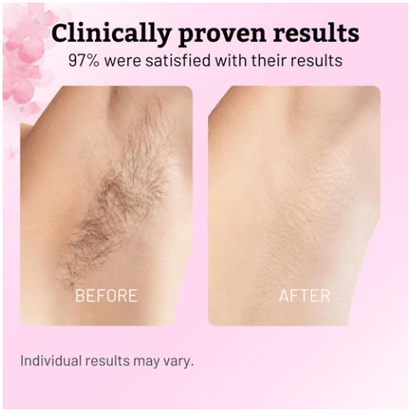 ✨Cyperus Rotundus Oil