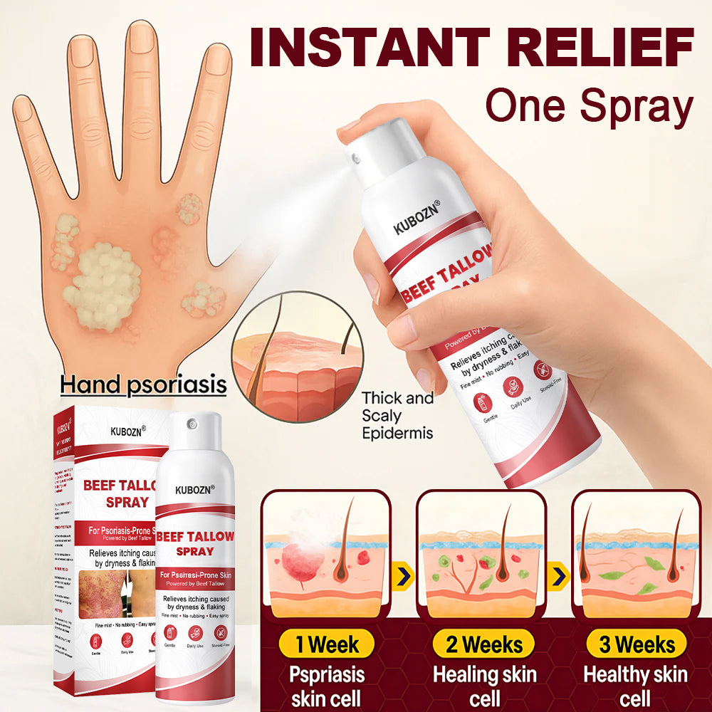 Lyyeto®  Beef Tallow Spray for Itchy. Flaky Psoriasis Skin 1