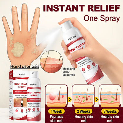 Lyyeto®  Beef Tallow Spray for Itchy. Flaky Psoriasis Skin 1