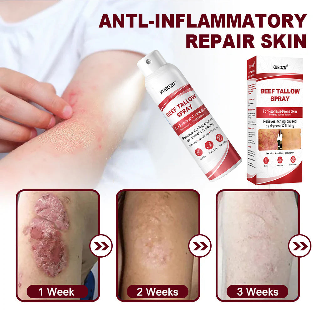 Lyyeto®  Beef Tallow Spray for Itchy. Flaky Psoriasis Skin 1