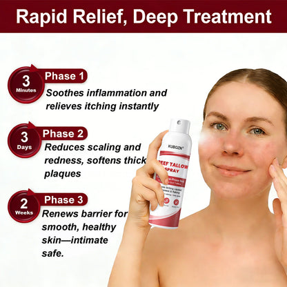 Lyyeto®  Beef Tallow Spray for Itchy. Flaky Psoriasis Skin 1