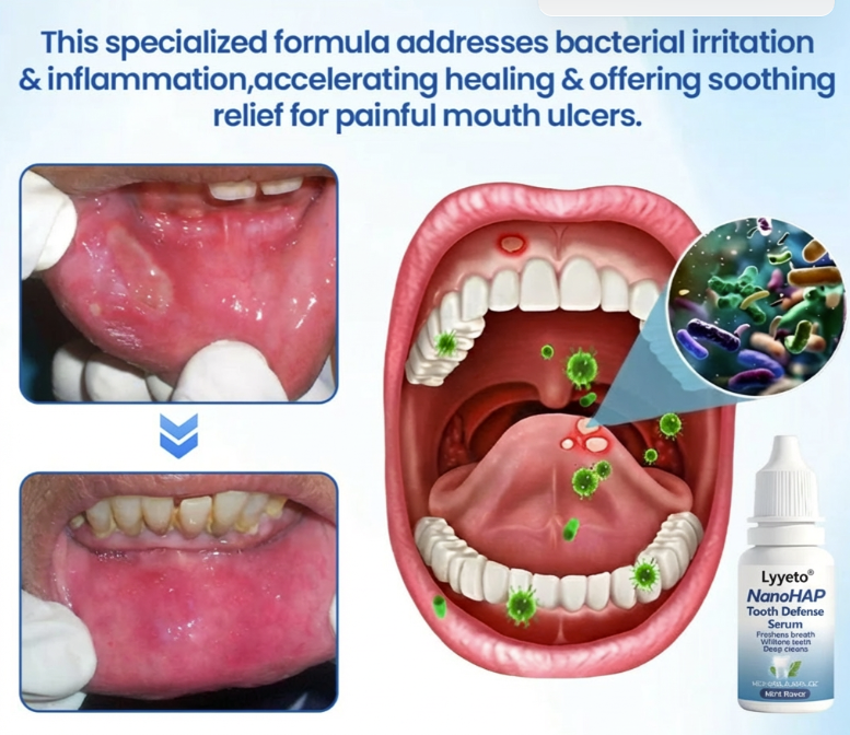 Lyyeto®  NanoHAP Tooth Defense Serum
