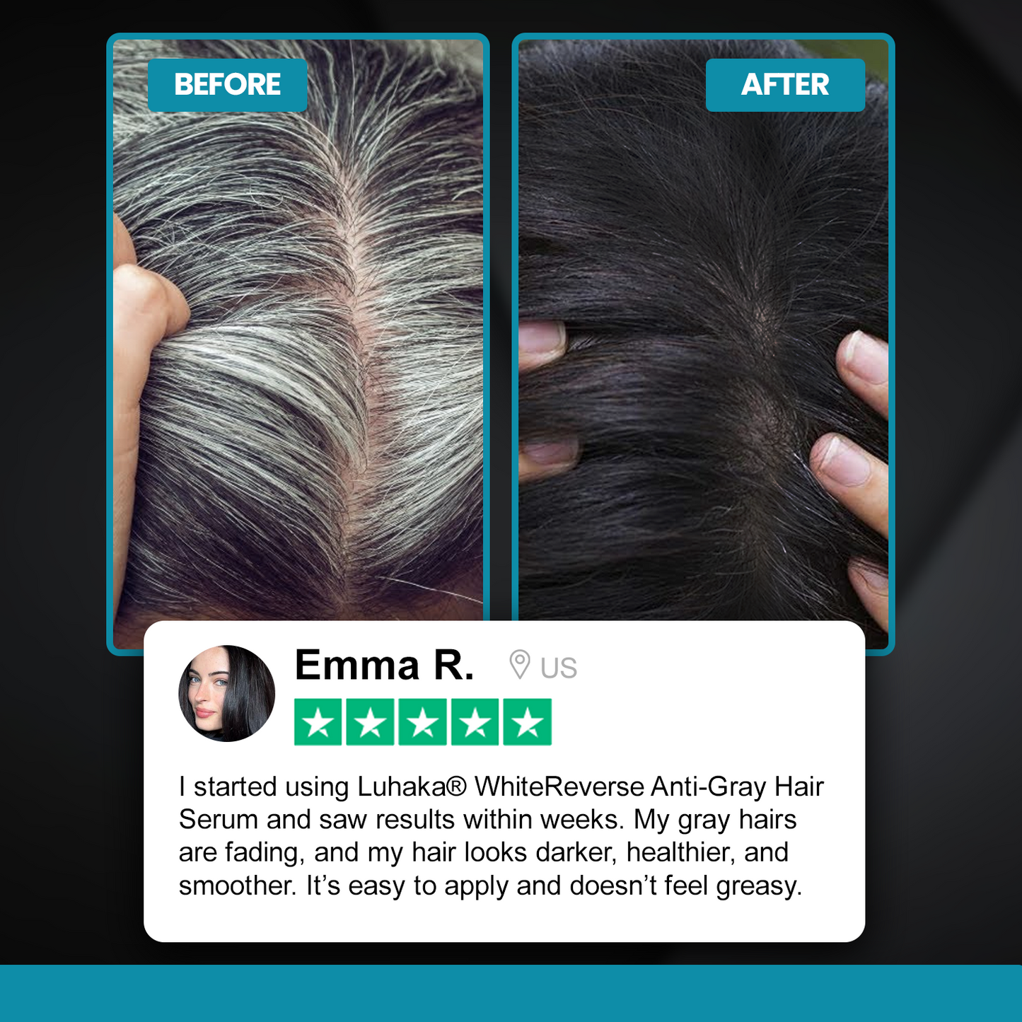 Luhaka® WhiteReverse Anti-Gray Hair Serum 1