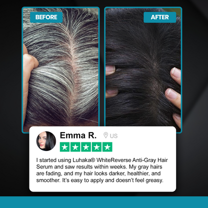 Luhaka® WhiteReverse Anti-Gray Hair Serum 1