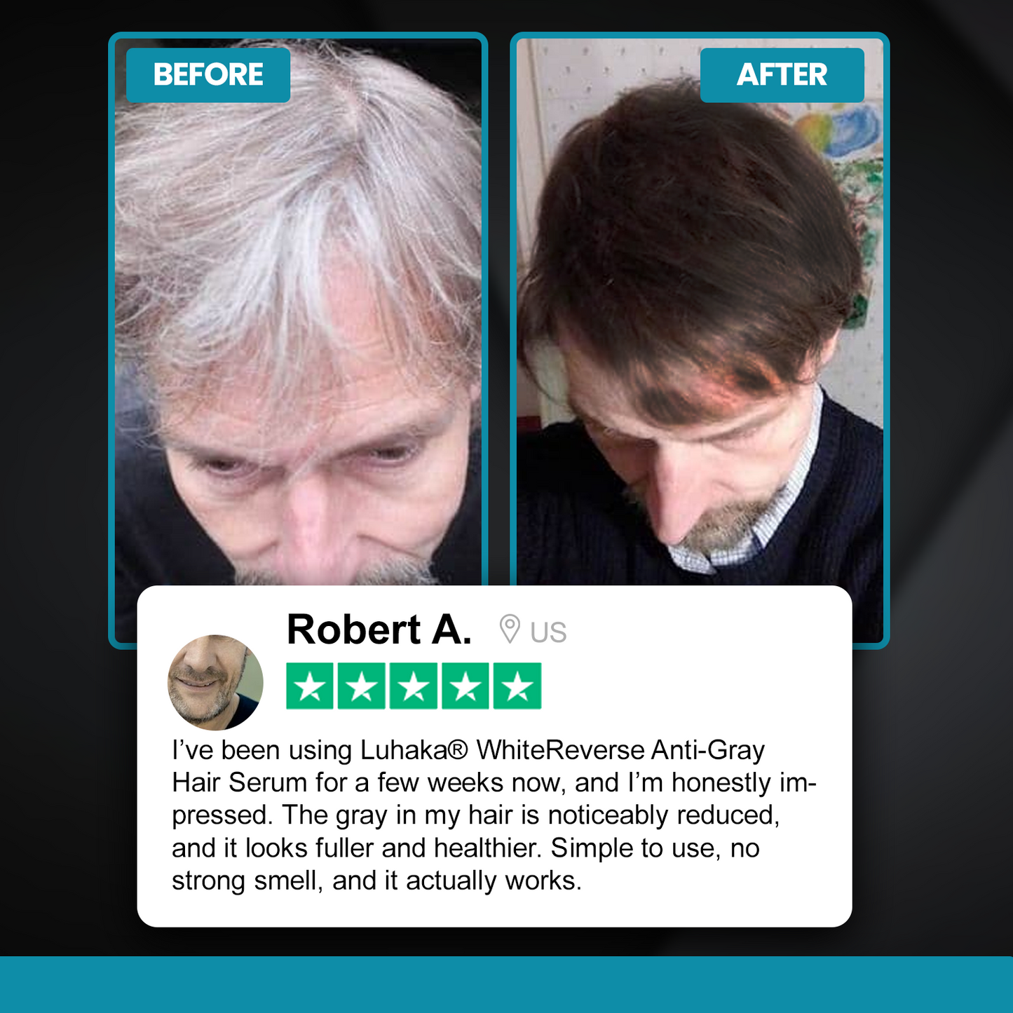 Luhaka® WhiteReverse Anti-Gray Hair Serum 1