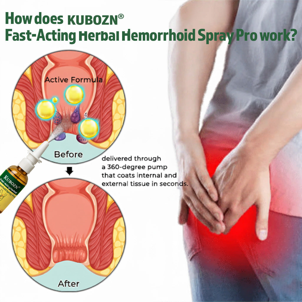Lyyeto®  Fast-Acting Herbal Hemorrhoid Spray Pro🩸(Stops Bleeding Instantly & Targets Internal/External Piles)
