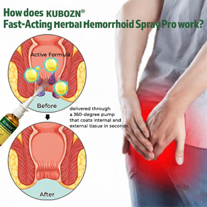 Lyyeto®  Fast-Acting Herbal Hemorrhoid Spray Pro🩸(Stops Bleeding Instantly & Targets Internal/External Piles)