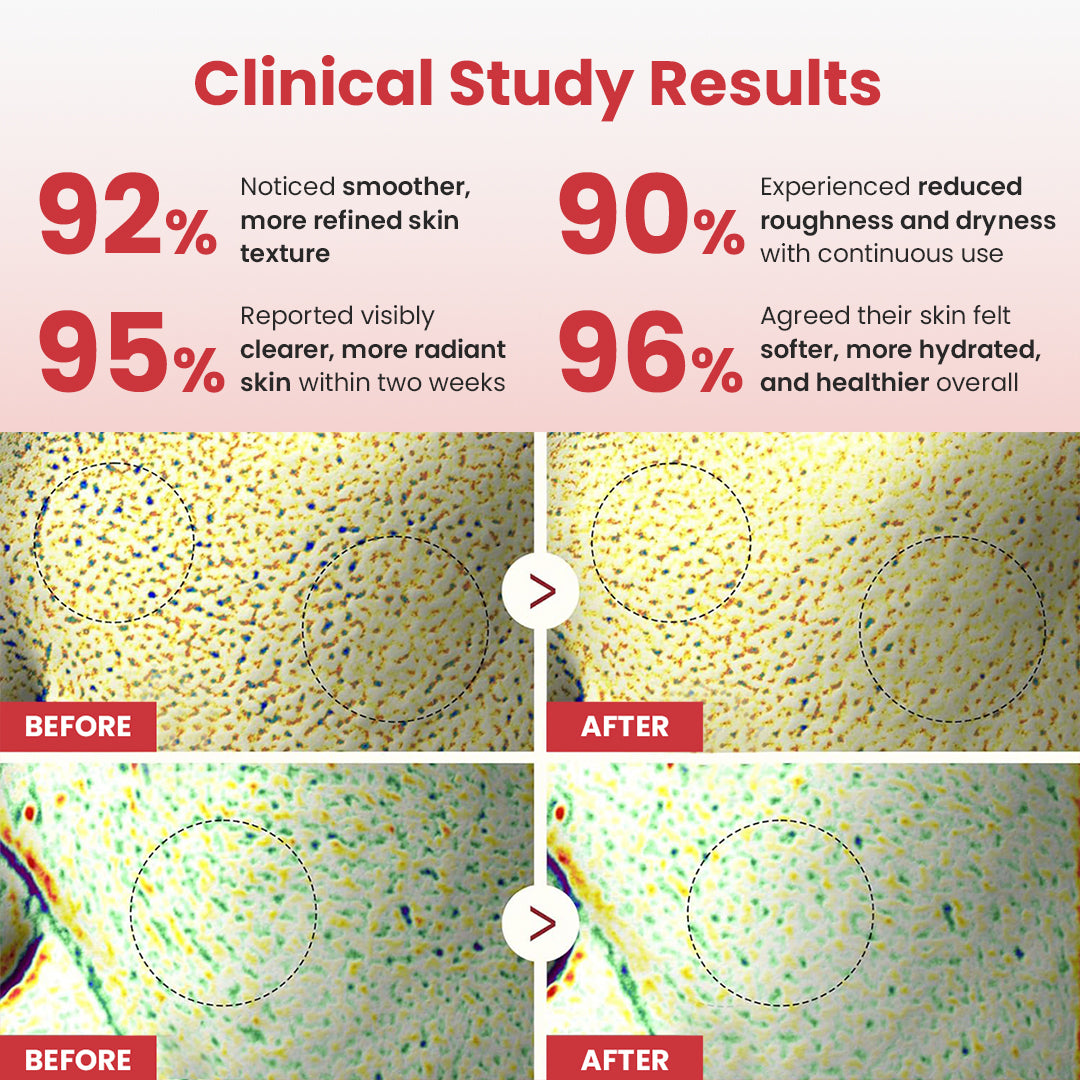 Luhaka® Hypochlorous Acid Rice Peel Shot Duo