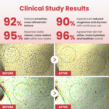 Luhaka® Hypochlorous Acid Rice Peel Shot Duo
