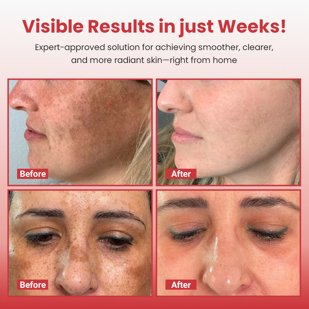 Luhaka® Hypochlorous Acid Rice Peel Shot Duo