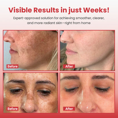 Luhaka® Hypochlorous Acid Rice Peel Shot Duo