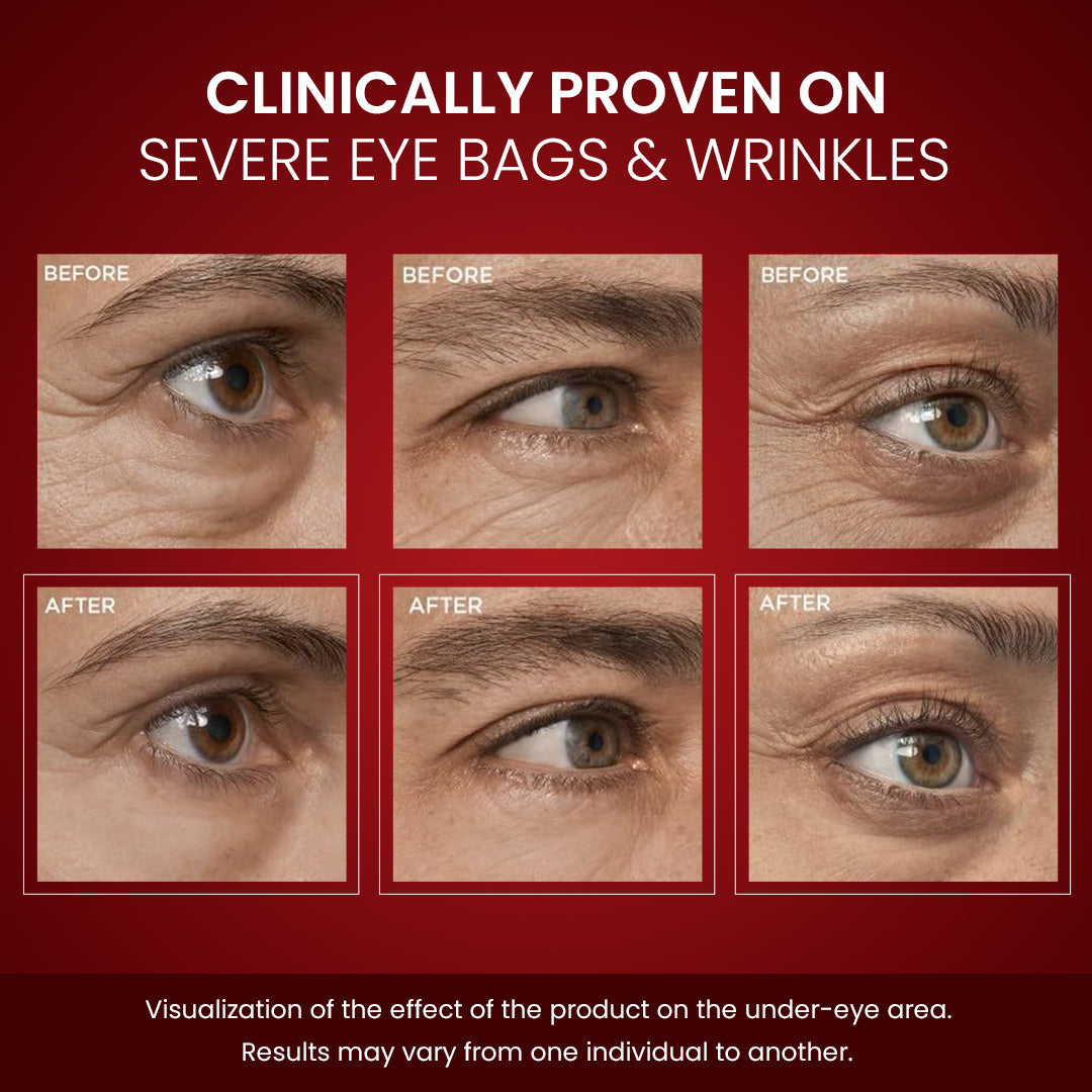 Luhaka® LumiLift Eye Bag Instant Eraser